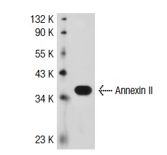 Annexin II (3D5): sc-47696. Western blot analysis of Annexin II expression in K-562 whole cell lysate.