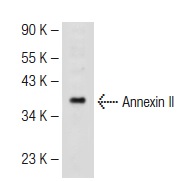 Annexin II (3D5): sc-47696. Western blot analysis of Annexin II expression in K-562 whole cell lysate.