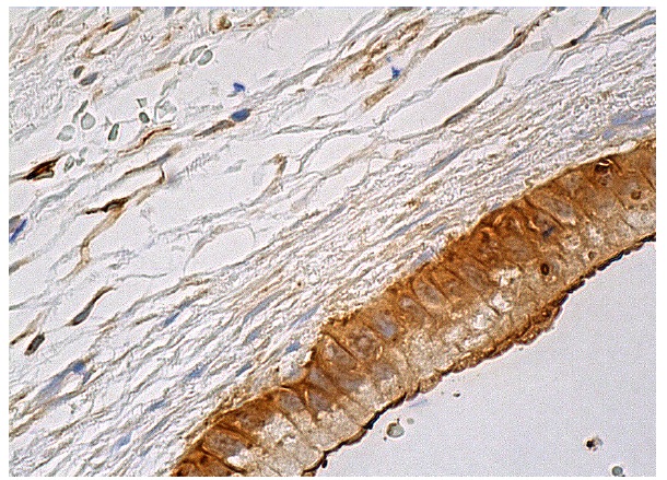 Annexin II (H-3): sc-271175. Immunoperoxidase staining of formalin fixed, paraffin-embedded human gall bladder tissue showing membrane and cytoplasmic staining of glandular cells.