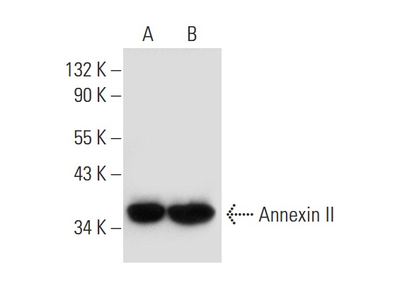 Annexin II (H-3): sc-271175. Western blot analysis of Annexin II expression in NIH/3T3 (A) and KNRK (B) whole cell lysates.