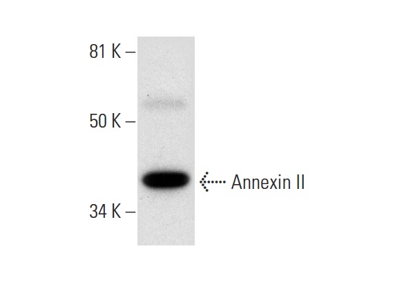 Annexin II (H-3): sc-271175. Western blot analysis of Annexin II expression in HeLa whole cell lysate.