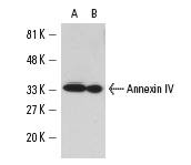 Annexin IV (D-2): sc-46693. Western blot analysis of Annexin IV expression in Caki-1 (A) and RAW 309 Cr.1 (B) whole cell lysates.