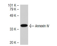 Annexin IV (D-2): sc-46693. Western blot analysis of Annexin IV expression in Hep G2 whole cell lysate.