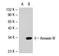 Annexin IV (D-2): sc-46693. Western blot analysis of Annexin IV expression in non-transfected: sc-117752 (A) and mouse Annexin IV transfected: sc-118433 (B) 293T whole cell lysates.