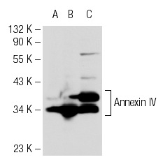 Annexin IV (FL-319): sc-28827. Western blot analysis of Annexin IV expression in non-transfected 293T: sc-117752 (A), mouse Annexin IV transfected 293T: sc-118433 (B) and KNRK (C) whole cell lysates.