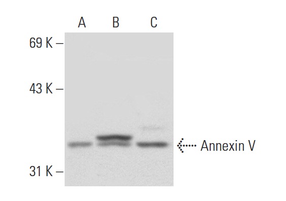 Annexin V (R-20): sc-1929. Western blot analysis of Annexin V expression in non-transfected 293T: sc-117752 (A), human Annexin V transfected 293T: sc-170257 (B) and HeLa (C) whole cell lysates.