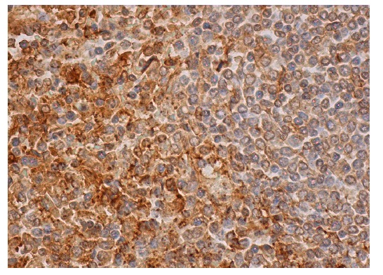 Annexin V (R-20): sc-1929. Immunoperoxidase staining of formalin fixed, paraffin-embedded human spleen tissue showing cytoplasmic staining of cells in white pulp and cells in red pulp.