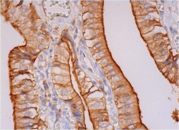 Annexin A13 (H-1): sc-377327. Immunoperoxidase staining of formalin fixed, paraffin-embedded human gall bladder tissue showing membrane and cytoplasmic staining of glandular cells.