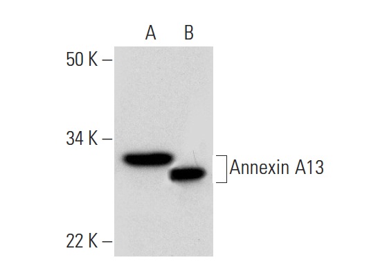 Annexin A13 (H-1): sc-377327. Western blot analysis of Annexin A13 expression in Caki-1 whole cell lysate (A) and human kidney tissue extract (B).