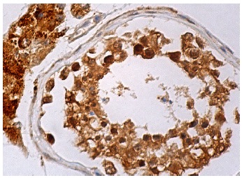 Apg-1 (B-7): sc-137007. Immunoperoxidase staining of formalin fixed, paraffin-embedded human testis tissue showing cytoplasmic and nuclear staining of cells in seminiferous ducts and Leydig cells.