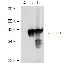 arginase I (N-20): sc-18351. Western blot analysis of arginase I expression in non-transfected: sc-117752 (A) and mouse arginase I transfected: sc-118520 (B) 293T whole cell lysates and mouse liver tissue extract (C).