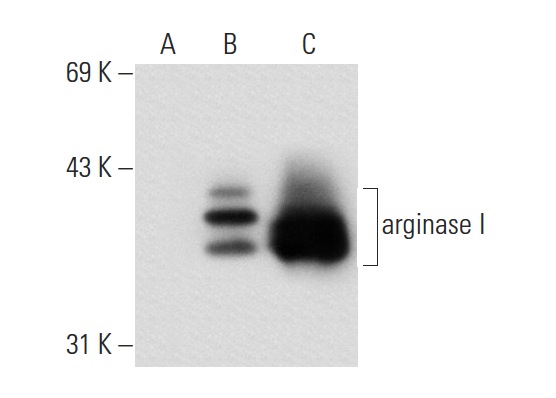 arginase I (N-20): sc-18351. Western blot analysis of arginase I expression in non-transfected: sc-117752 (A) and human arginase I transfected: sc-159833 (B) 293T whole cell lysates and mouse liver tissue extract (C).