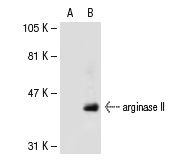 arginase II (P-20): sc-18360. Western blot analysis of arginase II expression in non-transfected: sc-117752 (A) and human arginase II transfected: sc-114274 (B) 293T whole cell lysates.
