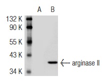 arginase II (P-20): sc-18360. Western blot analysis of arginase II expression in non-transfected: sc-117752 (A) and mouse arginase II transfected: sc-118522 (B) 293T whole cell lysates.