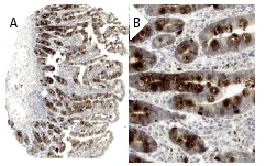 MK (A-9): sc-46701. Immunoperoxidase staining of formalin fixed, paraffin-embedded human duodenum tissue showing cytoplasmic staining of glandular cells at low (A) and high (B) magnification. Kindly provided by The Swedish Human Protein Atlas (HPA) program.