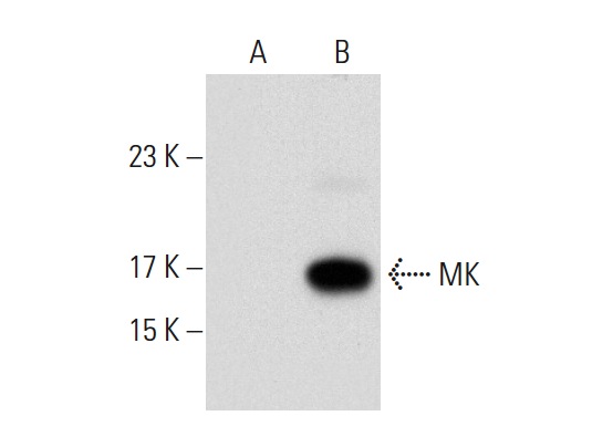 MK (A-9): sc-46701. Western blot analysis of MK expression in non-transfected: sc-117752 (A) and human MK transfected: sc-159960 (B) 293T whole cell lysates.