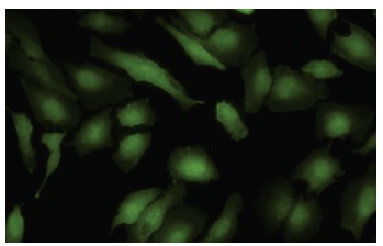 ARSA (7A): sc-100676. Immunofluorescence staining of paraformaldehyde-fixed HeLa cells showing cytoplasmic localization.