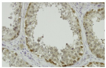 ARSA (7A): sc-100676. Immunoperoxidase staining of formalin-fixed, paraffin-embedded human testis tissue showing membrane localization.