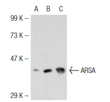 ARSA (7A): sc-100676. Western blot analysis of ARSA expression in non-transfected 293T: sc-117752 (A), mouse ARSA transfected 293T: sc-118575 (B) and HeLa (C) whole cell lysates.