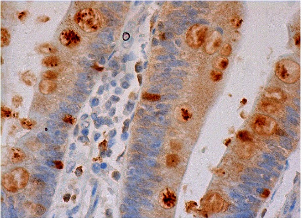 MK (A-9): sc-46701. Immunoperoxidase staining of formalin fixed, paraffin-embedded human small intestine tissue showing cytoplasmic staining of glandular cells.