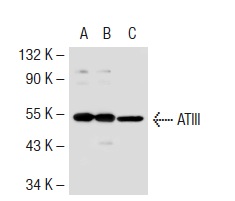 ATIII (C-18): sc-32453. Western blot analysis of ATIII expression in non-transfected 293T: sc-117752 (A), mouse ATIII transfected 293T: sc-118612 (B) and human PBL (C) whole cell lysates.