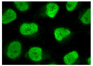 BLM hydrolase (A-19): sc-79876. Immunofluorescence staining of methanol-fixed HeLa cells showing nuclear localization.