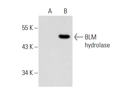 BLM hydrolase (H-300): sc-68888. Western blot analysis of BLM hydrolase expression in non-transfected: sc-117752 (A) and mouse BLM hydrolase transfected: sc-125060 (B) 293T whole cell lysates.