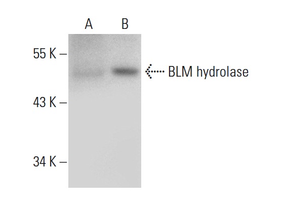 BLM hydrolase (H-300): sc-68888. Western blot analysis of BLM hydrolase expression in non-transfected: sc-117752 (A) and mouse BLM hydrolase transfected: sc-125058 (B) 293T whole cell lysates.