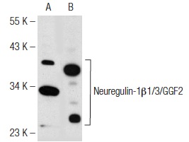Neuregulin-1β1/3/GGF2 (C-20): sc-347. Western blot analysis of Neuregulin-1β1/3/GGF2 expression in THP-1 (A) and MDA-MB-231 (B) whole cell lysates.