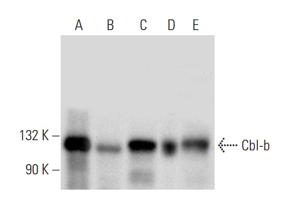Cbl-b (G-1): sc-8006. Western blot analysis of Cbl-b expression in CTLL-2 (A), WEHI-231 (B), BJAB (C), Jurkat (D) and K-562 (E) whole cell lysates.