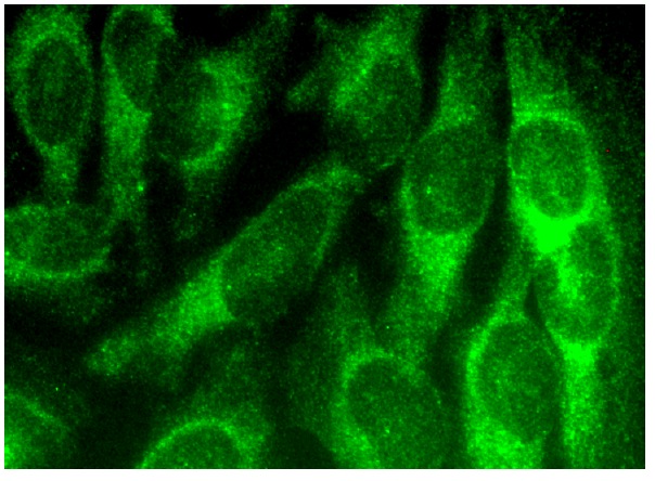 CHIP (H-231): sc-66830. Immunofluorescence staining of methanol-fixed HeLa cells showing cytoplasmic localization.