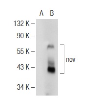 nov (F-8): sc-136966. Western blot analysis of nov expression in non-transfected: sc-110760 (A) and human nov transfected: sc-170566 (B) 293 whole cell lysates.