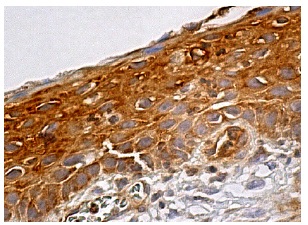 CIP4 (F-10): sc-166810. Immunoperoxidase staining of formalin fixed, paraffin-embedded human cervix tissue showing cytoplasmic staining of squamous epithelial cells.