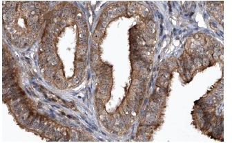 CIS (D-8): sc-74581. Immunoperoxidase staining of formalin fixed, paraffin-embedded human fallopian tube showing cytoplasmic staining of glandular cells at high magnification. Kindly provided by The Swedish Human Protein Atlas (HPA) program.