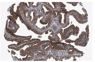 CIS (D-8): sc-74581. Immunoperoxidase staining of formalin fixed, paraffin-embedded human fallopian tube showing cytoplasmic staining of glandular cells at low magnification. Kindly provided by The Swedish Human Protein Atlas (HPA) program.