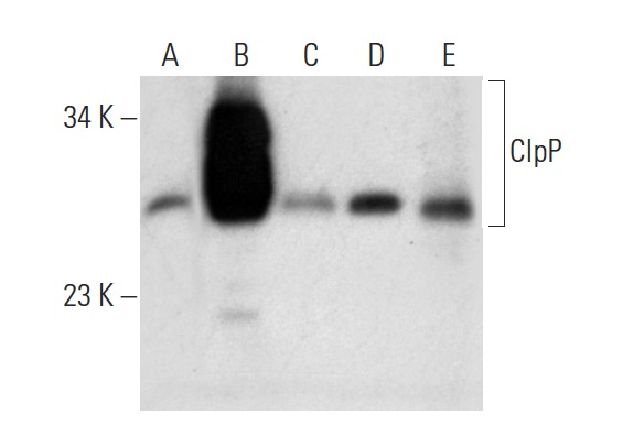 ClpP (FL-277): sc-134496. Western blot analysis of ClpP expression in non-transfected 293T: sc-117752 (A), human ClpP transfected 293T: sc-170553 (C), Saos-2 (D) and A-431 (E) whole cell lysates and mouse heart tissue extract (F).