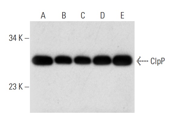 ClpP (FL-277): sc-134496. Western blot analysis of ClpP expression in K-562 (A), A549 (B), Hep G2 (C), HeLa (D) and Jurkat (E) whole cell lysates.