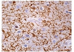 CNPase (G-6): sc-166063. Immunoperoxidase staining of formalin fixed, paraffin-embedded human brain tissue showing staining of neurofilaments.