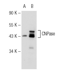 CNPase (B-9): sc-166254. Western blot analysis of CNPase expression in non-transfected: sc-110760 (A) and human CNPase transfected: sc-170132 (B) 293 whole cell lysates.