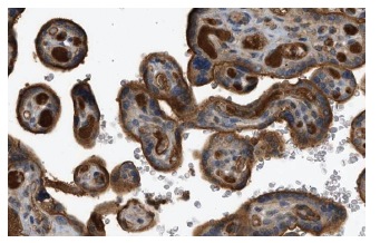 Factor VIII light chain (H-100): sc-33584. Immunoperoxidase staining of formalin fixed, paraffin-embedded human placenta tissue showing cytoplasmic staining of Decidual & Trophoblastic cells at high magnification. Kindly provided by The Swedish Human Protein Atlas (HPA) program.