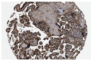 Factor VIII light chain (H-100): sc-33584. Immunoperoxidase staining of formalin fixed, paraffin-embedded human placenta tissue showing cytoplasmic staining of Decidual & Trophoblastic cells at low magnification. Kindly provided by The Swedish Human Protein Atlas (HPA) program.