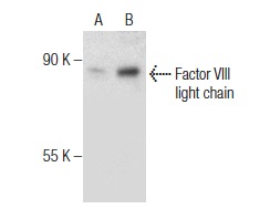 Factor VIII light chain (H-100): sc-33584. Western blot analysis of Factor VIII light chain expression in LNCaP (A) and MDA-MB-468 (B) whole cell lysates.