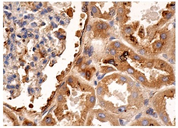 Factor VIII light chain (H-100): sc-33584. Immunoperoxidase staining of formalin fixed, paraffin-embedded human kidney tissue showing cytoplasmic staining of cells in glomeruli and tubules.