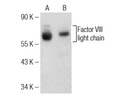 Factor VIII light chain (H-100): sc-33584. Western blot analysis of Factor VIII light chain expression in human platelet extract extract (A) and human kidney tissue extract (B).