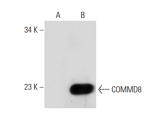 COMMD8 (N-15): sc-104159. Western blot analysis of COMMD8 expression in non-transfected: sc-117752 (A) and human COMMD8 transfected: sc-113950 (B) 293T whole cell lysates.