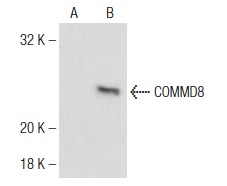 COMMD8 (N-15): sc-104159. Western blot analysis of COMMD8 expression in non-transfected: sc-117752 (A) and human COMMD8 transfected: sc-113950 (B) 293T whole cell lysates.
