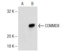 COMMD8 (N-15): sc-104159. Western blot analysis of COMMD8 expression in non-transfected: sc-117752 (A) and mouse COMMD8 transfected: sc-119380 (B) 293T whole cell lysates.