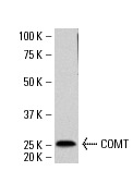 COMT (FL-271): sc-25844. Western blot analysis of COMT expression in IMR-32 whole cell lysate.