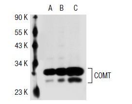 COMT (FL-271): sc-25844. Western blot analysis of COMT expression in non-transfected 293T: sc-117752 (A), human COMT transfected 293T: sc-111755 (B) and K-562 (C) whole cell lysates.