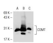COMT (FL-271): sc-25844. Western blot analysis of COMT expression in non-transfected 293T: sc-117752 (A), human COMT transfected 293T: sc-111755 (B) and Jurkat (C) whole cell lysates.